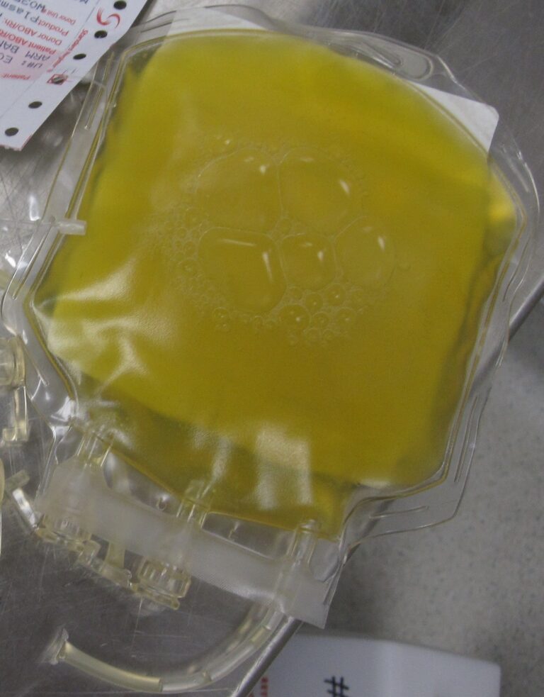 FDA將允許醫生用康復者血漿治療重症新冠狀病毒患者